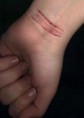 /album/fotogaleria/autolesiones-adolescentes-jpg/